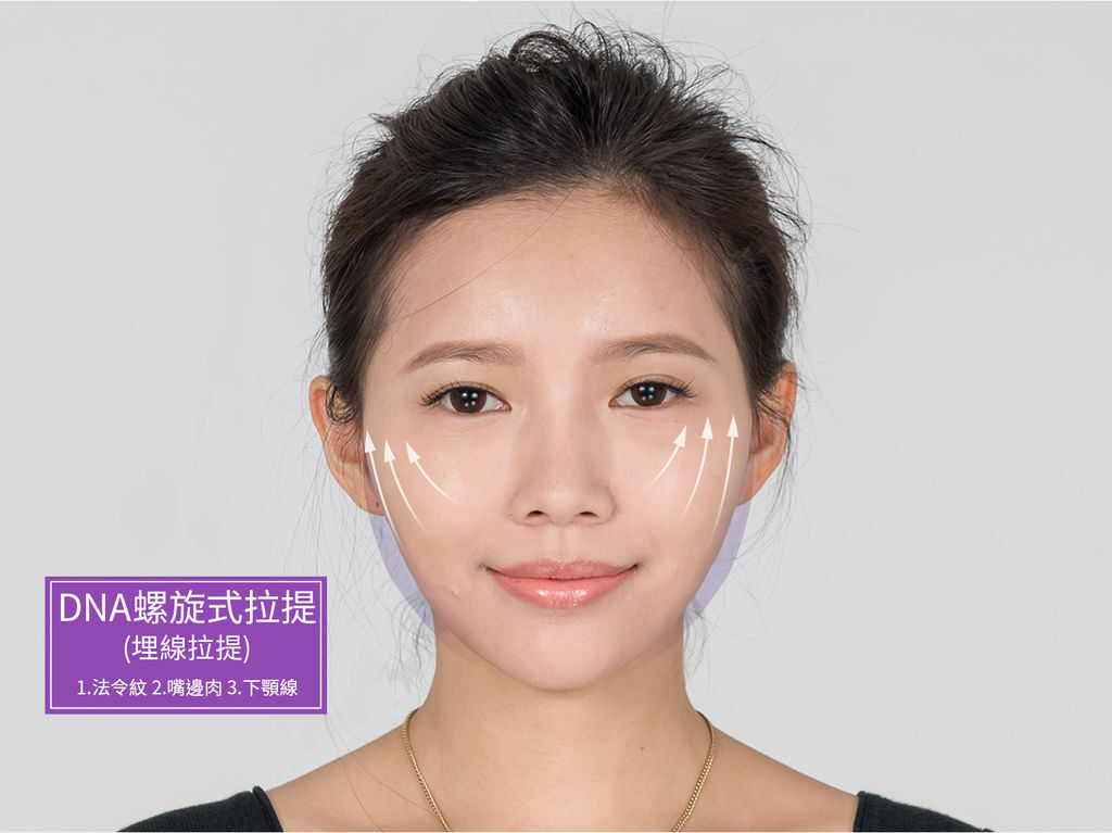 埋線拉提副作用埋線拉提費用埋線拉提推薦埋線拉提術後埋線拉提ptt埋線拉提後遺症埋線拉提效果玫瑰線拉提價格4d埋線拉皮推薦平滑線拉提嘴邊肉治療推薦光彩時尚診所郭弘義醫師015.jpg 埋線拉提副作用埋線拉提費用埋線拉提推薦埋線拉提術後埋線拉提ptt埋線拉提後遺症埋線拉提效果玫瑰線拉提價格4d埋線拉皮推薦平滑線拉提嘴邊肉治療推薦光彩時尚診所郭弘義醫師015.jpg