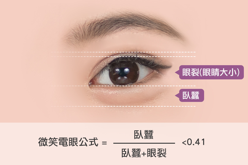 玻尿酸臥蠶ptt玻尿酸臥蠶推薦玻尿酸臥蠶費用光彩時尚診所郭弘義醫師03.jpg 玻尿酸臥蠶ptt玻尿酸臥蠶推薦玻尿酸臥蠶費用光彩時尚診所郭弘義醫師03.jpg
