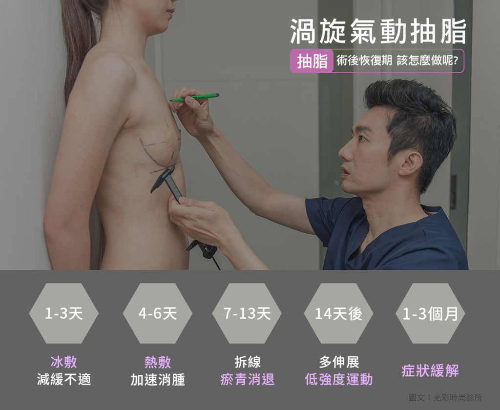 台北抽脂推薦醫師 傳統抽脂 水刀抽脂 雷射溶脂 抽脂比較 東區醫美 光彩時尚診所1.jpg 台北抽脂推薦醫師 傳統抽脂 水刀抽脂 雷射溶脂 抽脂比較 東區醫美 光彩時尚診所1.jpg