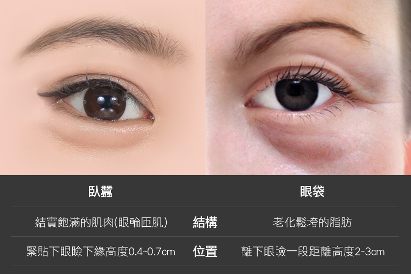 光彩時尚診所玻尿酸郭弘義醫師玻尿酸臥蠶臥蠶比例顏值自然臥蠶東區醫美推薦02.jpg 光彩時尚診所玻尿酸郭弘義醫師玻尿酸臥蠶臥蠶比例顏值自然臥蠶東區醫美推薦02.jpg
