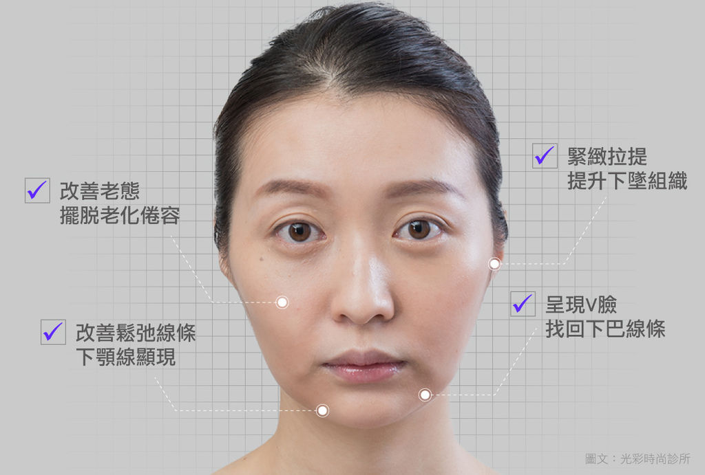 埋線拉皮費用埋線拉提失敗埋線拉皮後遺症埋線拉提推薦埋線拉皮術後埋線拉提副作用玫埋.jpg 埋線拉皮費用埋線拉提失敗埋線拉皮後遺症埋線拉提推薦埋線拉皮術後埋線拉提副作用玫埋.jpg