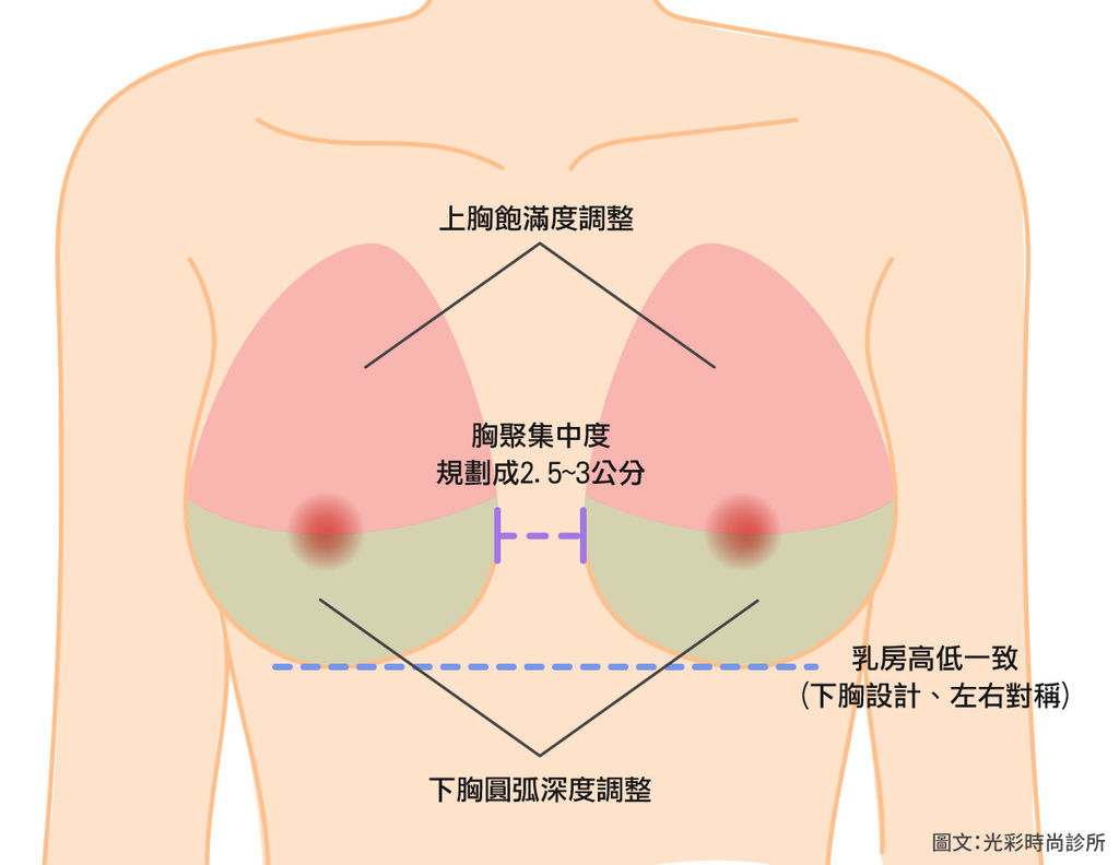 胸型規劃首圖2019性感胸型乳溝內視鏡隆乳光彩時尚診所台北醫美推薦費用評價ptt術後修復期水滴隆乳果凍矽膠手術風險