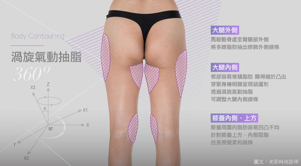 自體脂肪豐臀翹臀抽脂手術費用抽脂費用抽脂會痛嗎自體脂肪移植威塑抽脂傳統抽脂大腿抽脂後遺症光彩時尚診所郭弘義醫師台北埋線拉提推薦醫師東區醫美推薦台北抽脂推薦2.jpg 自體脂肪豐臀翹臀抽脂手術費用抽脂費用抽脂會痛嗎自體脂肪移植威塑抽脂傳統抽脂大腿抽脂後遺症光彩時尚診所郭弘義醫師台北埋線拉提推薦醫師東區醫美推薦台北抽脂推薦2.jpg