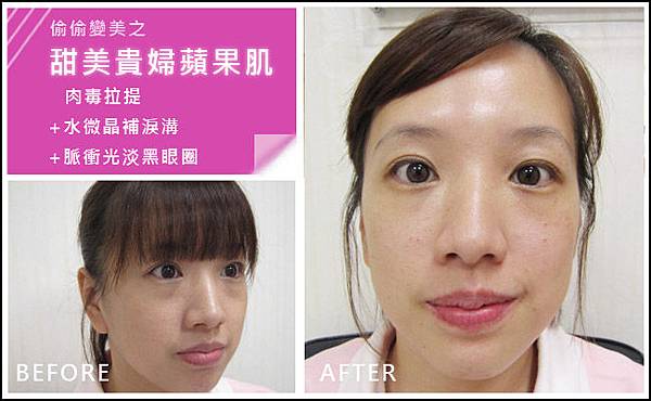 貴婦頻果肌 貴婦頻果肌