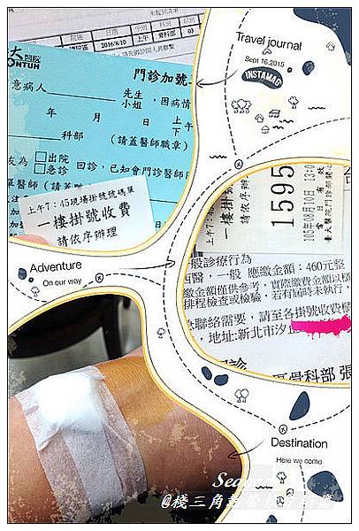 三角韌帶軟骨損傷 三角韌帶軟骨損傷