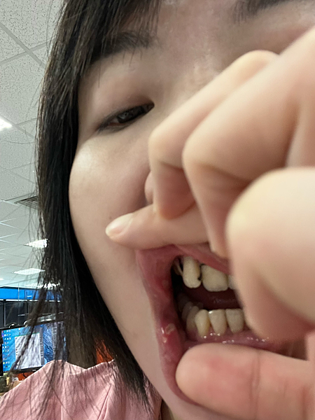 我的牙齒矯正日記-明圳齒顎矯正診所,一段長長的變美之路 我的牙齒矯正日記-明圳齒顎矯正診所,一段長長的變美之路