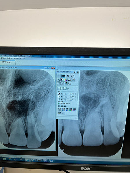 我的牙齒矯正日記-明圳齒顎矯正診所,一段長長的變美之路 我的牙齒矯正日記-明圳齒顎矯正診所,一段長長的變美之路