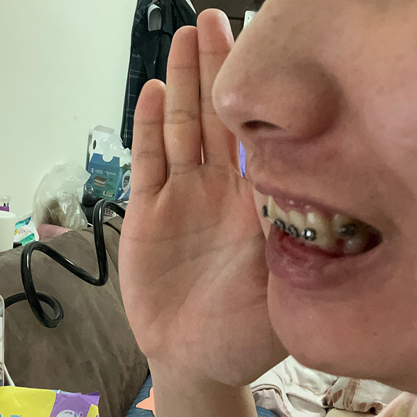 我的牙齒矯正日記-明圳齒顎矯正診所,一段長長的變美之路 我的牙齒矯正日記-明圳齒顎矯正診所,一段長長的變美之路