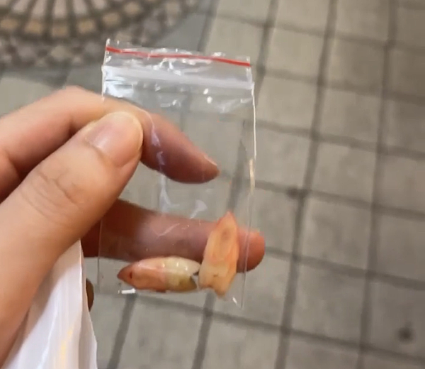 我的牙齒矯正日記-明圳齒顎矯正診所,一段長長的變美之路 我的牙齒矯正日記-明圳齒顎矯正診所,一段長長的變美之路