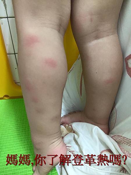 【潛力種子】登革熱知多少？