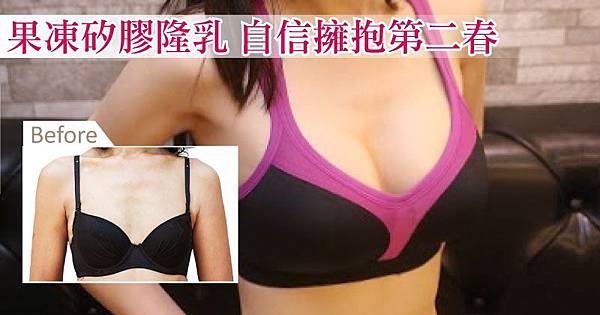 800-隆乳6.jpg 800-隆乳6.jpg