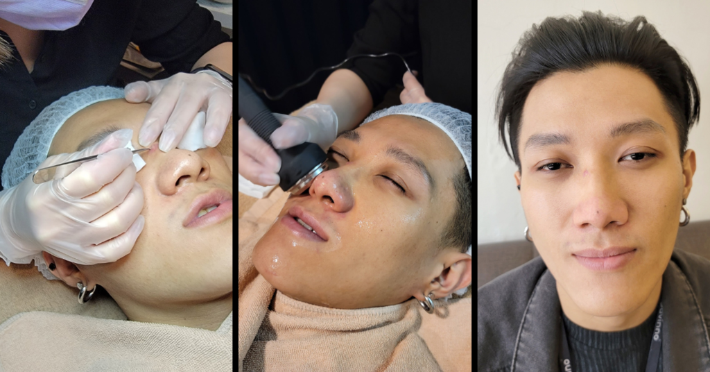 台南男生做臉推薦！男人的自我投資，告別油光滿面、痘痘粉刺，讓