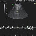 小乖34W超音波心跳.jpg