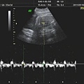 小乖35W3d超音波心跳.jpg