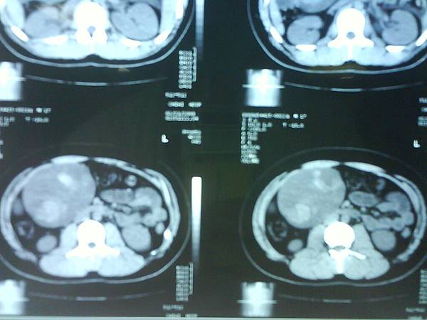 CT with contrast