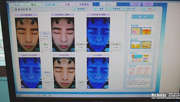 術前Janus專業肌膚檢測11.jpg