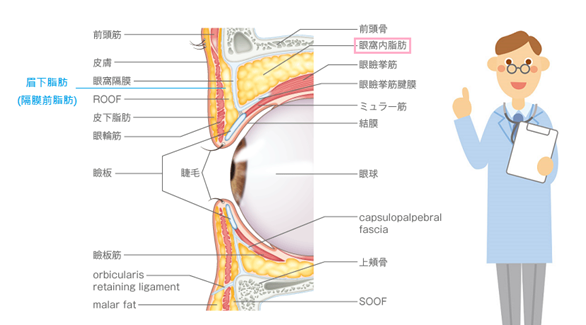 眉下脂肪移除+開放式雙眼皮手術-作者沈筠惇醫師