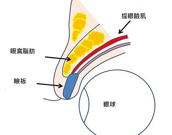 眼瞼解剖.jpg