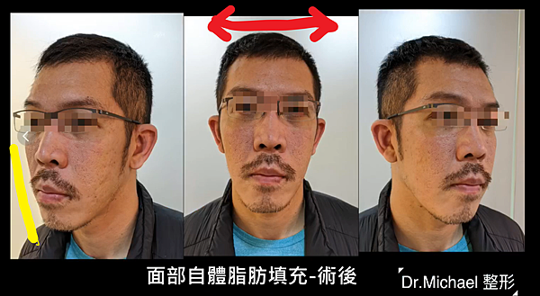 未命名2 未命名2