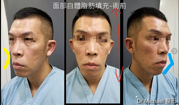 未命名 未命名