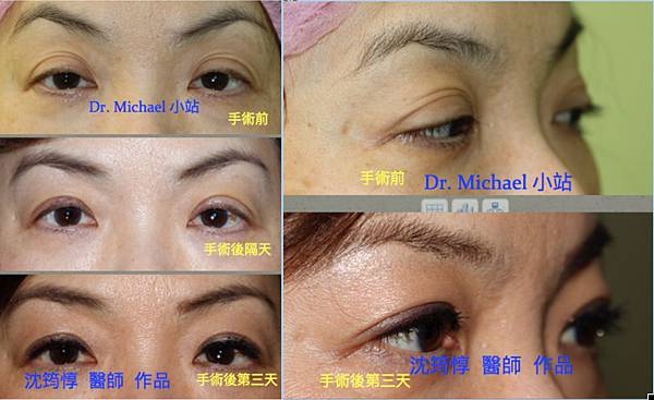 註解 2020-05-19 132656 註解 2020-05-19 132656