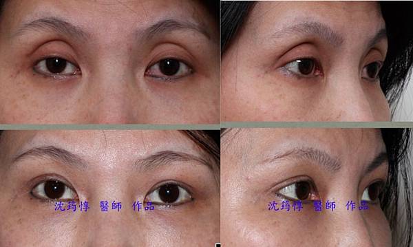 註解 2020-05-19 132830 註解 2020-05-19 132830