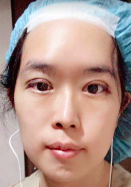 [心得] 大心～剛縫好雙眼皮了