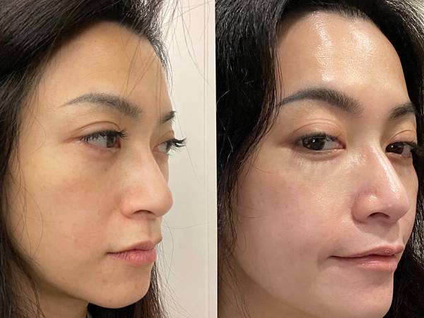 吃出耀眼亮亮肌YouPink日妍亮亮玻尿酸錠 吃出耀眼亮亮肌YouPink日妍亮亮玻尿酸錠