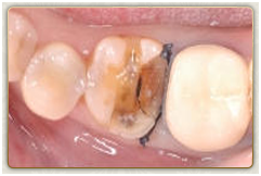 你聽過 3d齒雕 了沒 世樺植牙美學專科中心 痞客邦