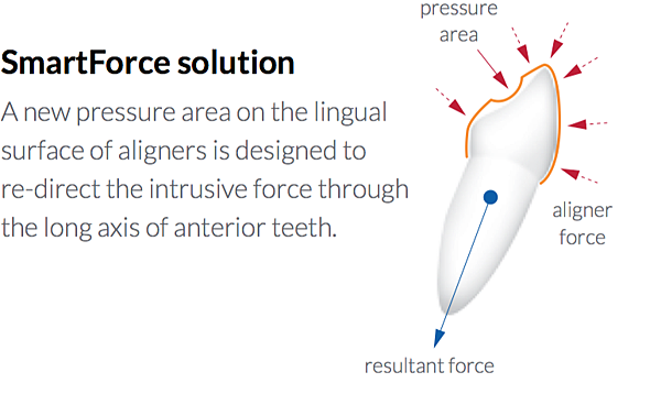 invisalign_G5-1