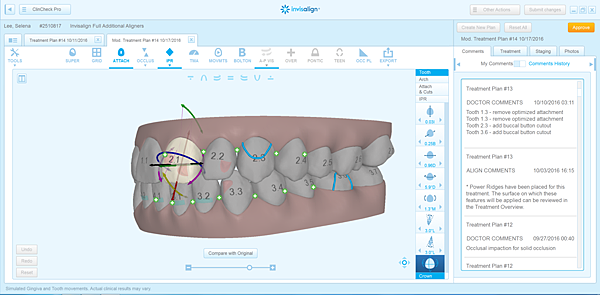 Clincheck pro 5