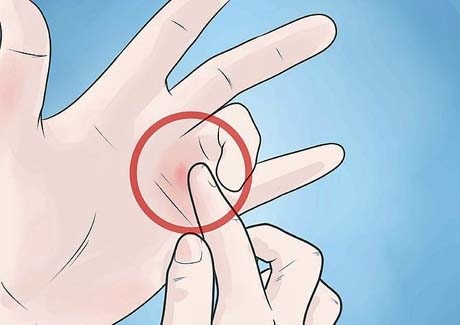 670px-Know-if-You-Have-Trigger-Finger-Step-2_0.jpg 670px-Know-if-You-Have-Trigger-Finger-Step-2_0.jpg