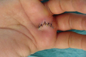 surgery_risks.JPG surgery_risks.JPG