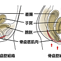 應力性尿失禁.png