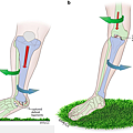 ankle-ACL.png