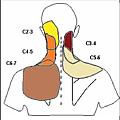 The-patterns-of-referred-pain-from-the-cervical-zygapophysial-joints-7.png