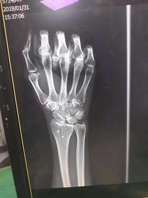 20190131_162348.jpg 20190131_162348.jpg