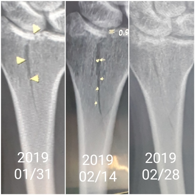 20190228_160042 20190228_160042