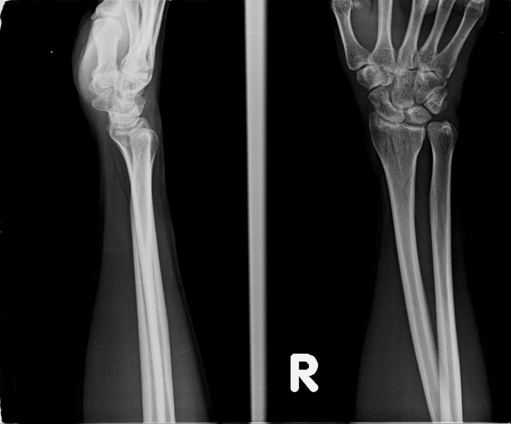 20190228_A.jpg 20190228_A.jpg