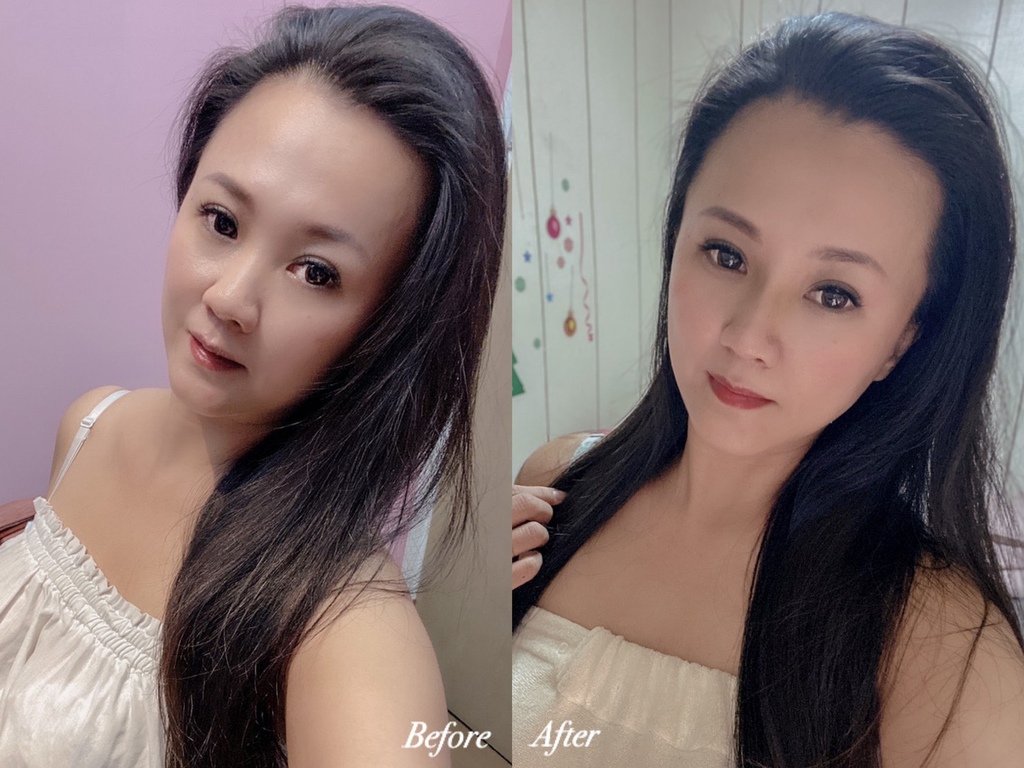 鼻雕埋線會痛嗎 我的線雕隆鼻分享 不動刀讓鼻子變挺 上妝不再畫鼻影 我是呂萱萱 吃喝玩樂愛分享