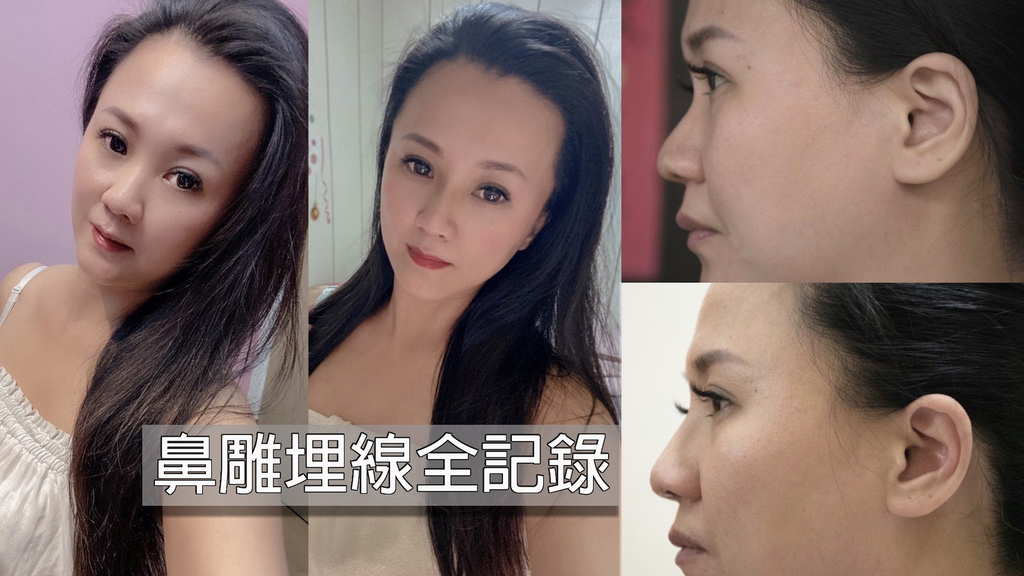 鼻雕埋線會痛嗎 我的線雕隆鼻分享 不動刀讓鼻子變挺 上妝不再畫鼻影 我是呂萱萱 吃喝玩樂愛分享