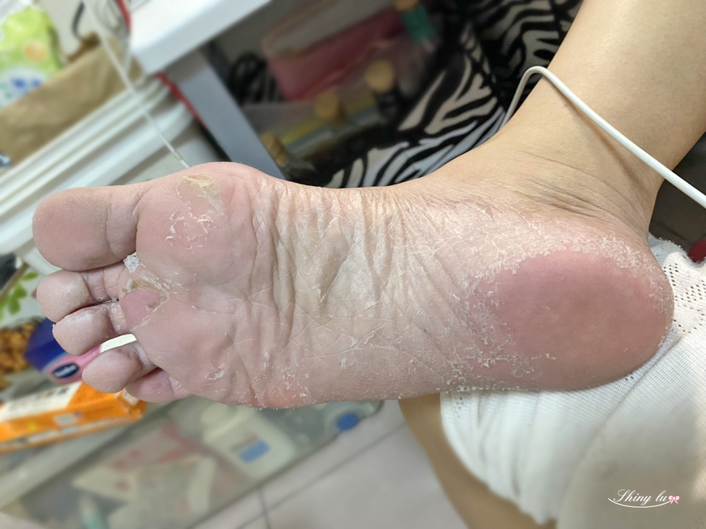 史上超強足膜大評比 足膜使用方法 足膜脫皮可以撕嗎 忽視後續保養小心變爛腳 我是呂萱萱 吃喝玩樂愛分享 痞客邦 史上超強足膜大評比 足膜使用方法 足膜脫皮可以撕嗎 忽視後續保養小心變爛腳 我是呂萱萱 吃喝玩樂愛分享 痞客邦