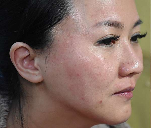 杏仁酸怎麼用 杏仁酸可以每天用嗎 杏仁酸使用順序q A 各大品牌杏仁酸評比 文章持續更新中 我是呂萱萱 吃喝玩樂愛分享