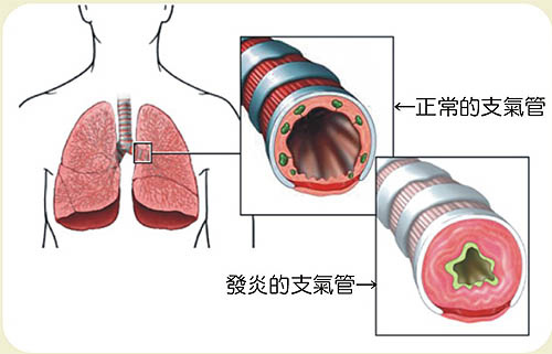 支氣管