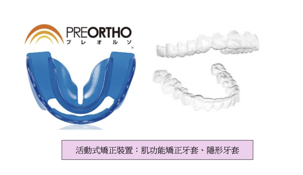「牙齒矯正」牙齒矯正需要多久時間？高雄牙醫推薦