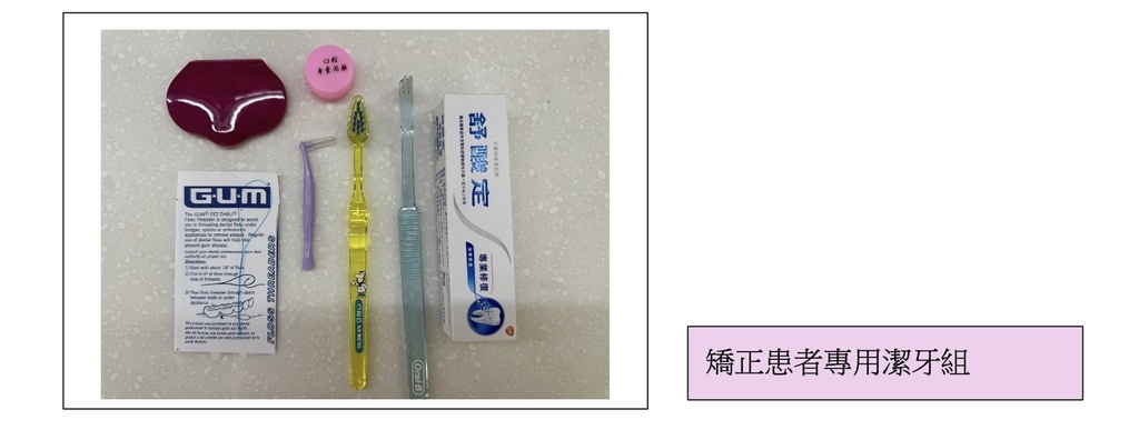 「牙齒矯正」牙齒矯正是不是會很容易蛀牙？高雄牙醫推薦