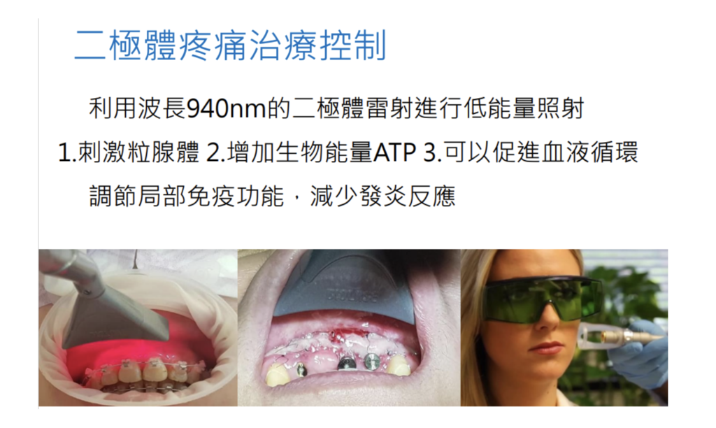 「二極體雷射」二極體雷射適合用在哪些牙科治療上
