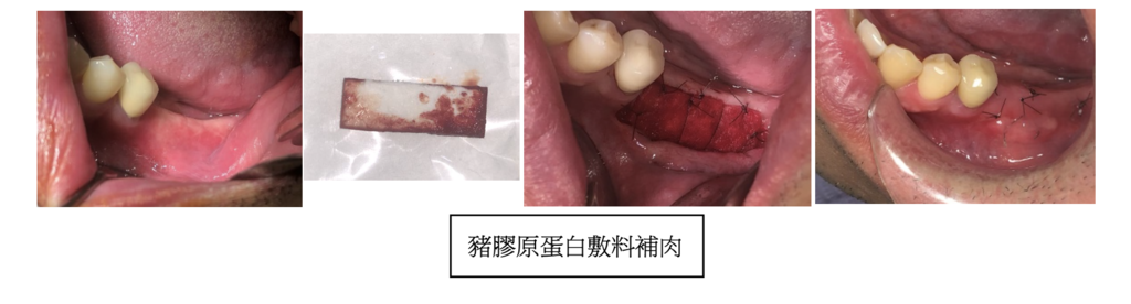 高雄牙醫/左營牙醫/牙醫推薦/高雄植牙 高雄牙醫/左營牙醫/牙醫推薦/高雄植牙