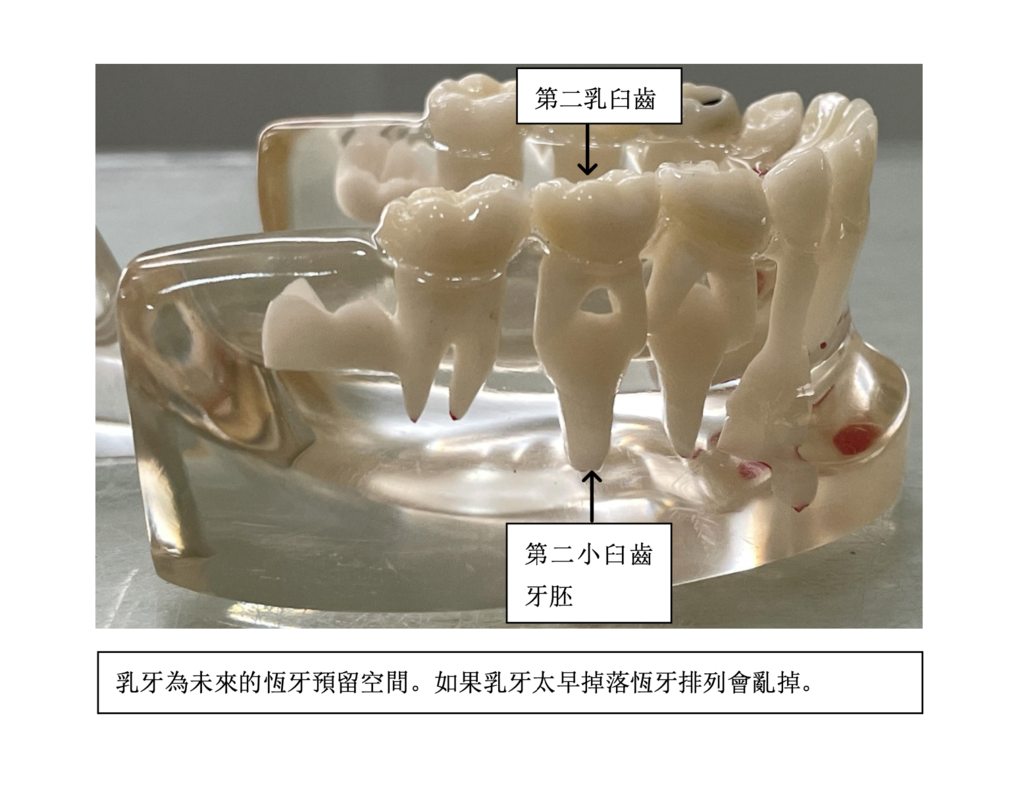 「兒童牙科」乳牙是否可以進行根管治療?高雄牙醫/左營牙醫/牙醫推薦 「兒童牙科」乳牙是否可以進行根管治療?高雄牙醫/左營牙醫/牙醫推薦