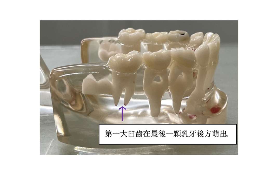 「兒童牙科」小朋友覺得最後方的牙齦腫,怎麼辦?高雄牙醫/左營牙醫/牙醫推薦 「兒童牙科」小朋友覺得最後方的牙齦腫,怎麼辦?高雄牙醫/左營牙醫/牙醫推薦